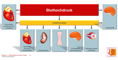 Bild zeigt Gefäßschäden bei Bluthochdruck / arterielle Hypertonie